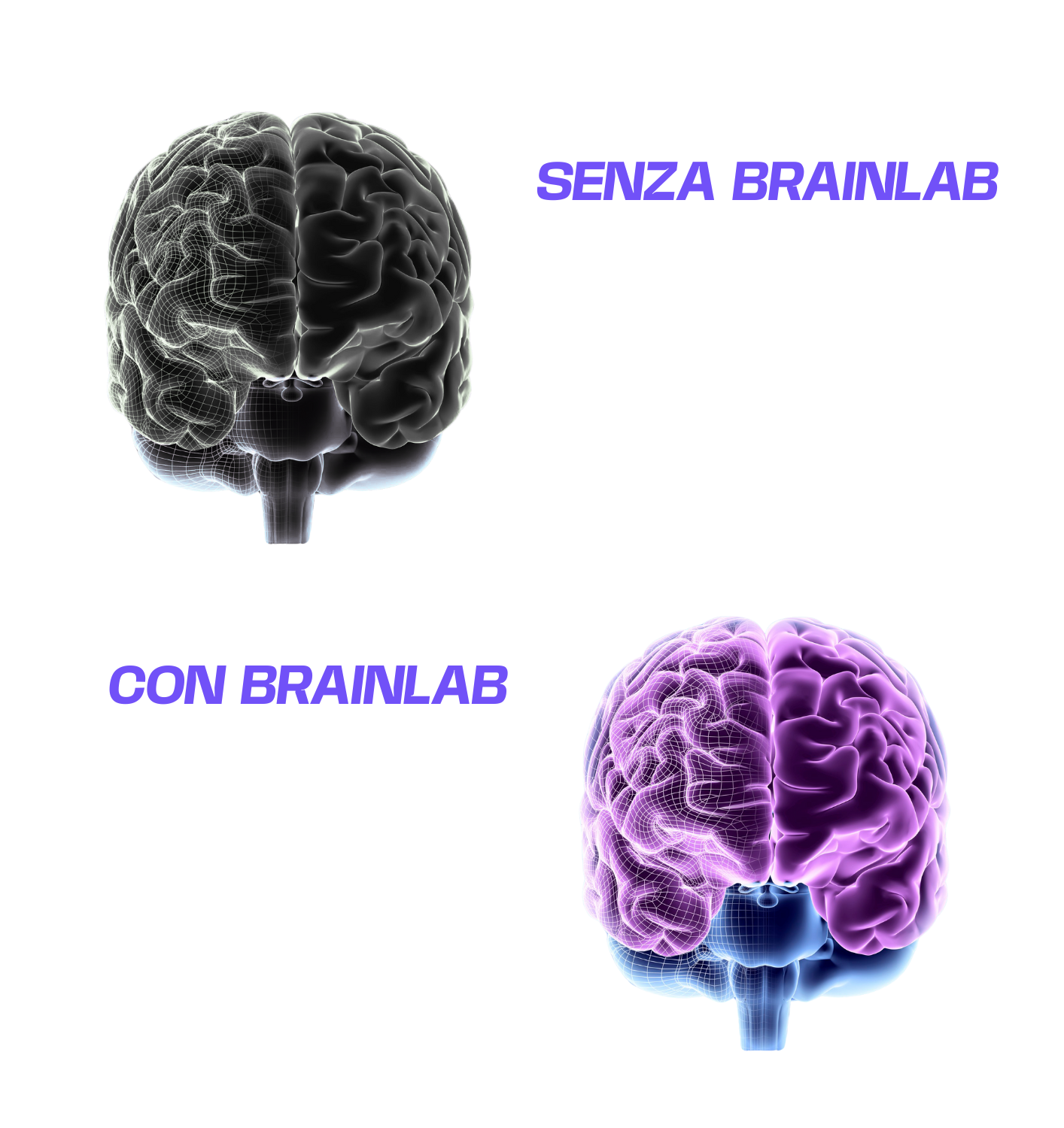 Effetti BrainLab